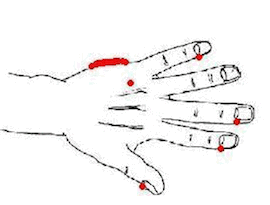 eft-procedurec